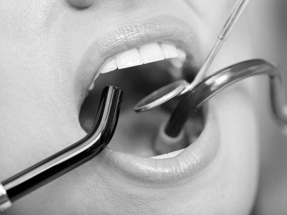 חרדה דנטלית